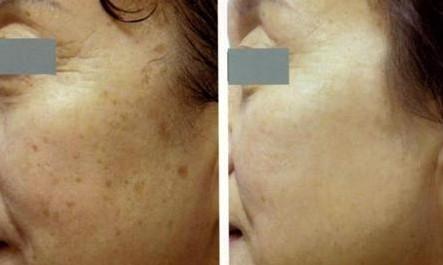 ������ôȥ�����©